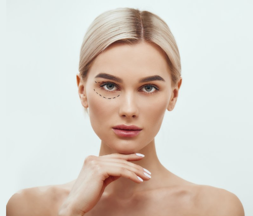 Blepharoplasty